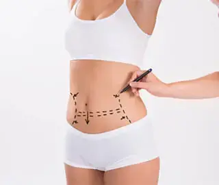 Lipoescultura laser en cdmx | Dr. Ivan Silva