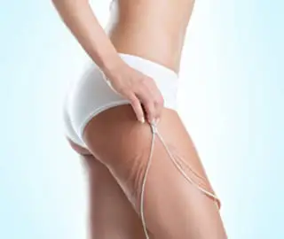 Vacumterapia en cdmx | Dr. Ivan Silva